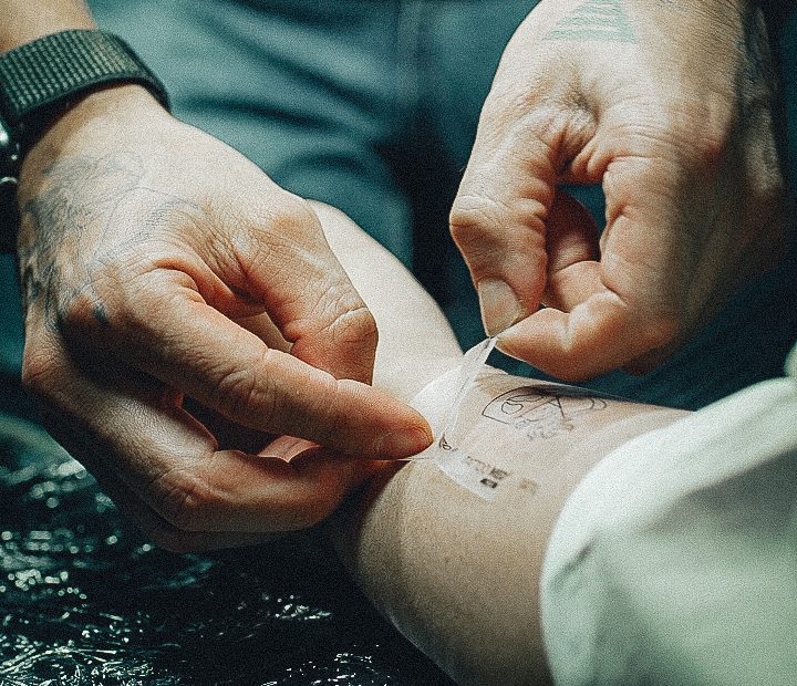 etterbehandling tatovering
